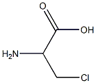 3-氯-DL-丙氨酸 结构式