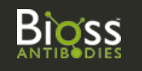 Beijing Biosynthesis Biotechnology Co Ltd