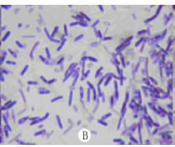 生孢梭菌的应用