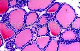 甲状腺球蛋白的临床应用