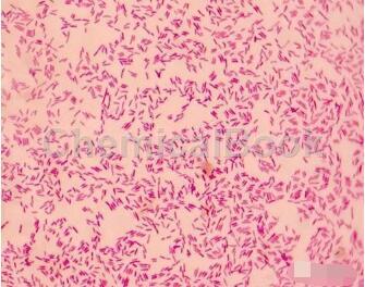 痢疾杆菌图片显微镜图片
