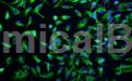 3T3-L1/小鼠胚胎成纤维细胞的相关研究