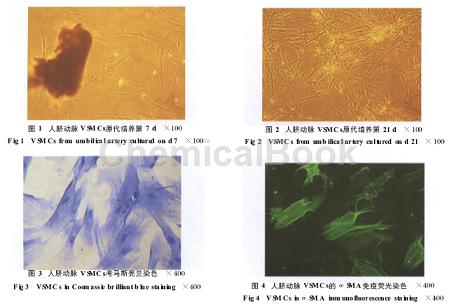 脐动脉平滑肌细胞（人源）的培养