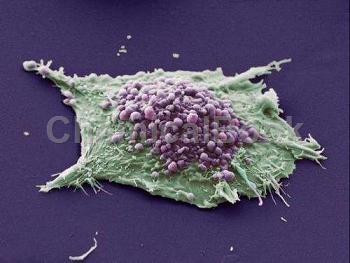 人肺癌组织源细胞提取物的应用