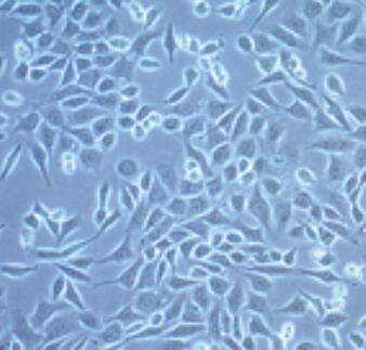 ID8小鼠卵巢癌细胞介绍及培养