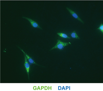 小鼠抗GAPDH单克隆抗体的应用