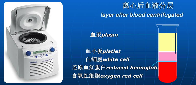 胎牛血清在冷冻离心机中进行分离