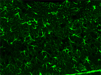 ANTI-GFAP POLYCLONAL ANTIBODY的应用