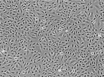 内皮细胞培养基的应用