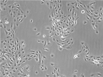 小鼠肝星状细胞的应用