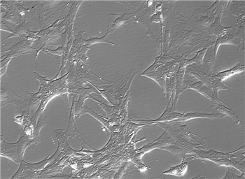 大鼠星形胶质细胞条件培养基-无血清RACM-SF的应用