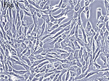 成人骨髓间充质干细胞完全培养基的应用