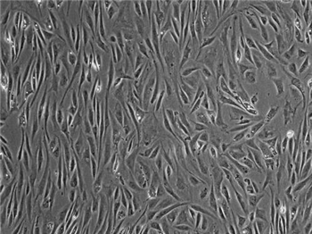WISTAR大鼠骨髓间充质干细胞完全培养基的应用