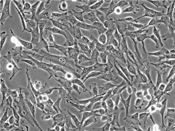 恒河猴骨髓间充质干细胞完全培养基的应用