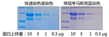 考马斯亮蓝染色试剂盒(常规法)