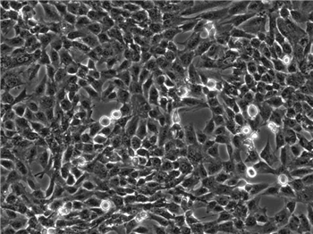 人骨髓基质细胞HS-5的应用
