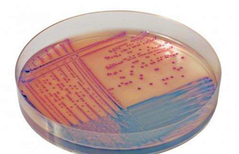 沙门氏菌显色培养基的应用