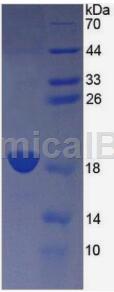 CD320分子(CD320)重组蛋白的相关研究和实验