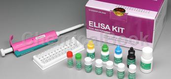人脂磷壁酸(LTA)ELISA试剂盒的操作步骤