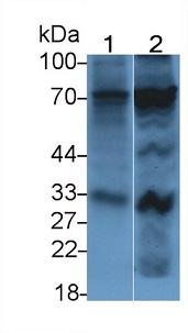 2'-5'-寡腺苷酸合成酶2抗体的应用