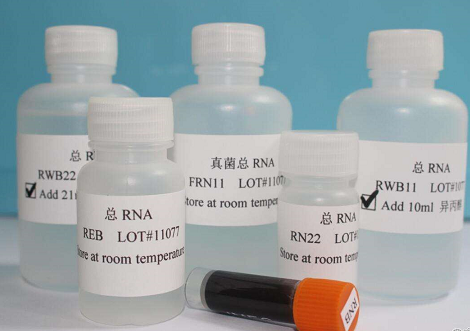 EASYSPIN 细菌RNA快速提取试剂盒