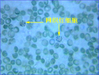 网织红细胞染色液的应用