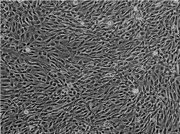 TM4(正常小鼠睾丸SERTOLI细胞)的应用