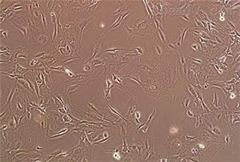 U87MG 人恶性胶质母细胞瘤细胞的应用