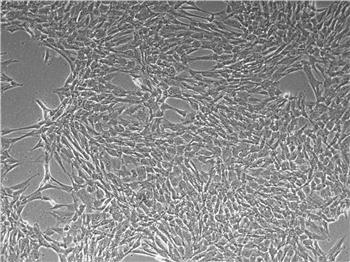  间充质干细胞培养基的应用