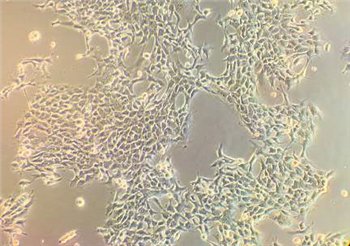 人胚肾细胞293T的应用