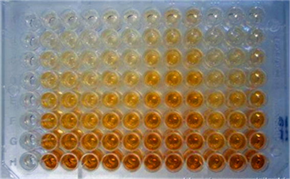 人11去氢血栓烷B2(11-DH-TXB2)ELISA KIT的应用