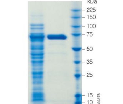 组氨酸标签蛋白染色试剂盒的应用
