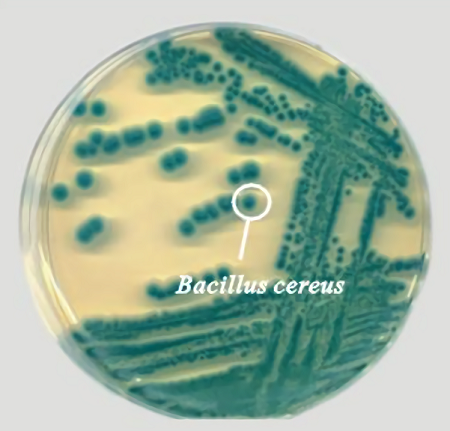 蜡样芽胞杆菌显色培养基的应用