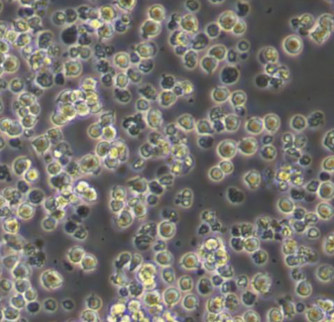 KCL-22人慢性粒细胞白血病传代细胞系的应用