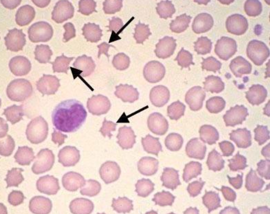 RED BLOOD CELL LYSIS BUFFER 红细胞裂解液的应用