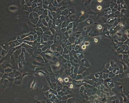 NG108-15 [108CC15]小鼠神经细胞瘤与大鼠神经胶质瘤之融合细胞的应用