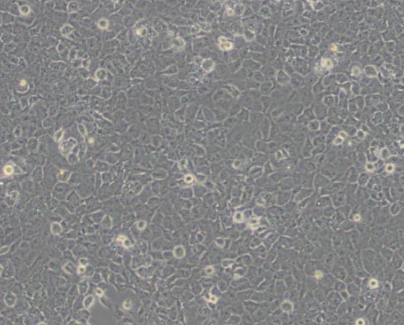 T24人膀胱移行细胞癌细胞