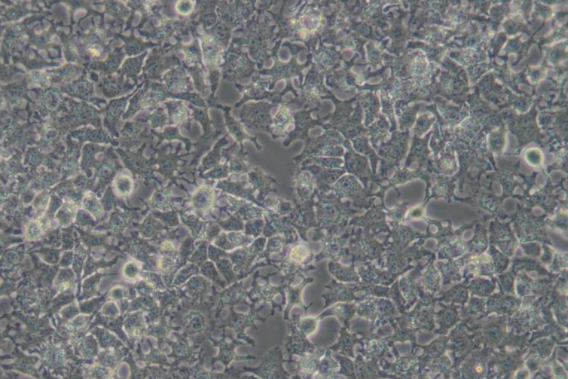 HUH-6人肝母细胞瘤细胞的应用