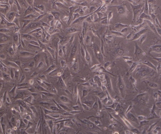 NCI-N87人胃癌细胞