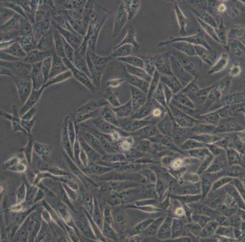 ZR-75-1人乳腺癌细胞