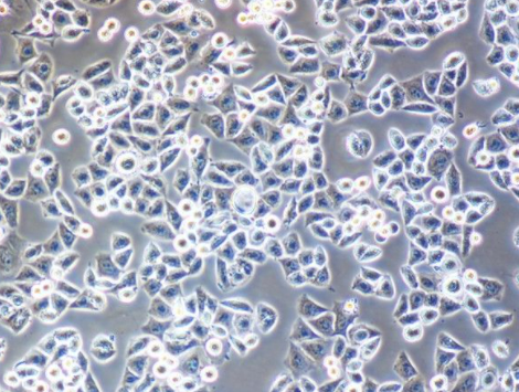 NEURO-2A] 小鼠脑神经瘤细胞