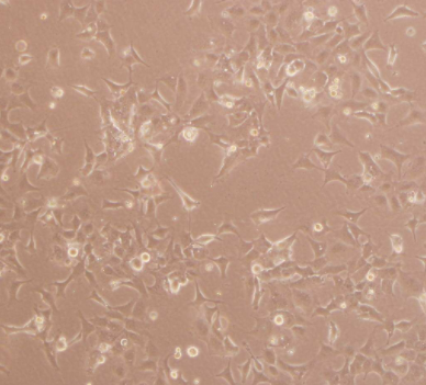 HCC78人肺腺癌贴壁细胞系