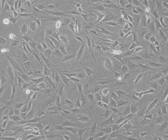 小鼠胚胎成纤维细胞(MEF)完全培养基的应用