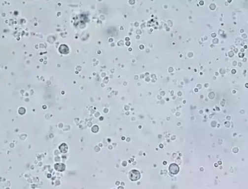 前列腺颗粒细胞图片