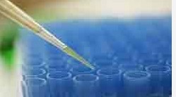 TSLP淋巴细胞生成素-1（抗原）,Thymic stromal lymphopoietin isoform 1