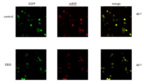 mRFP-EGFP-LC3穩(wěn)轉(zhuǎn)細(xì)胞株,mRFP-EGFP-LC3