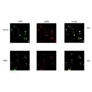 mRFP-EGFP-LC3稳转细胞株