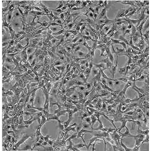 EBTr(NBL-4)贴壁复苏细胞系