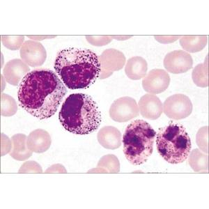 人外周血白血病T细胞 ；Jurkat细胞