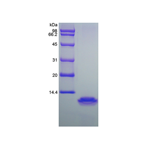重组人巨噬细胞炎性蛋白4/CCL18